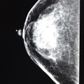 A image of a healthy breast taken by Northwest Breast Imaging Center on Tuesday at Willow Creek. Hea...