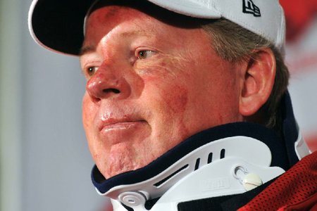 gr-4petrino55pCLR