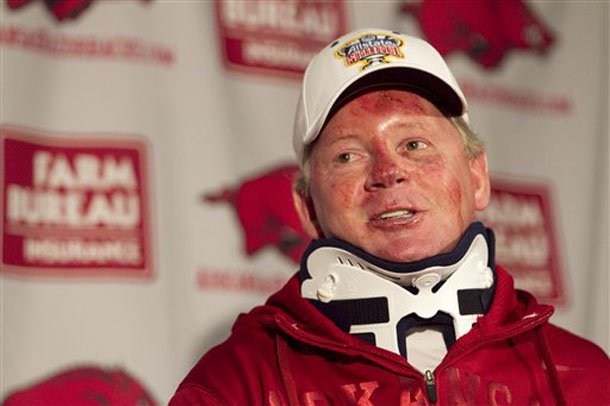 arkansas-football-coach-bobby-petrino-speaks-during-a-news-conference-in-fayetteville-on-tuesday-april-3-2012-after-being-released-from-a-hospital