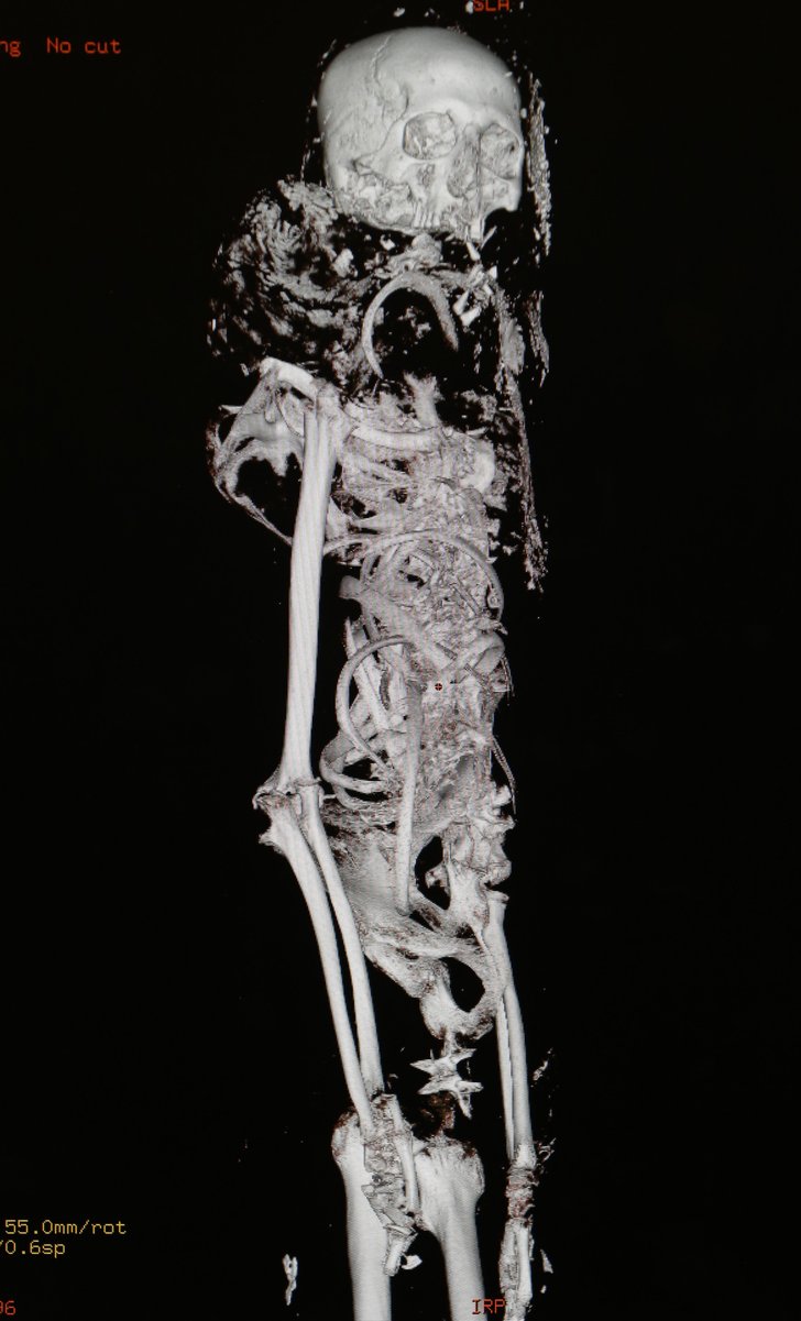 Photo detail