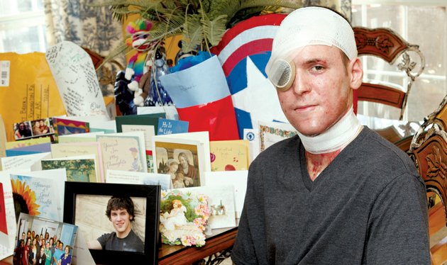 robert-brooks-22-of-conway-has-received-cards-and-prayers-from-all-over-the-country-after-he-was-burned-dec-12-in-a-chemical-explosion-at-his-workplace-brooks-said-doctors-are-amazed-at-his-progress-on-monday-hendrix-college-will-dedicate-waltz-night-to-brooks-a-hendrix-graduate-and-professional-musician