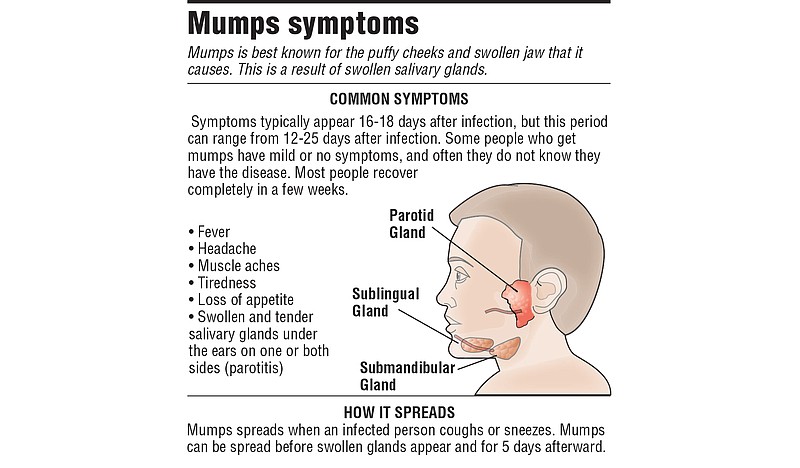 Mumps found, another case suspected at UA